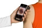 Handyscope is new skin cancer exam device for the iPhone