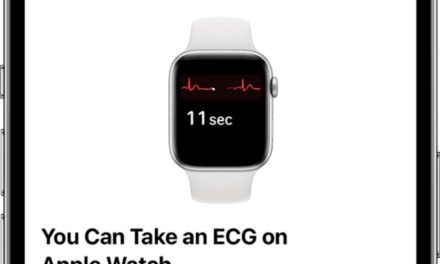 Apple Watch has a slight advantage over competing devices in providing ECG data