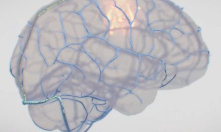 Apple working with Synchron on a brain-computer interface