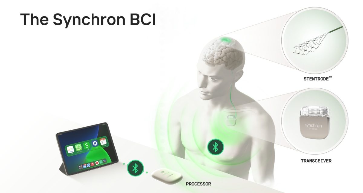 Synchron Debuts First Thought-Controlled iPad Experience