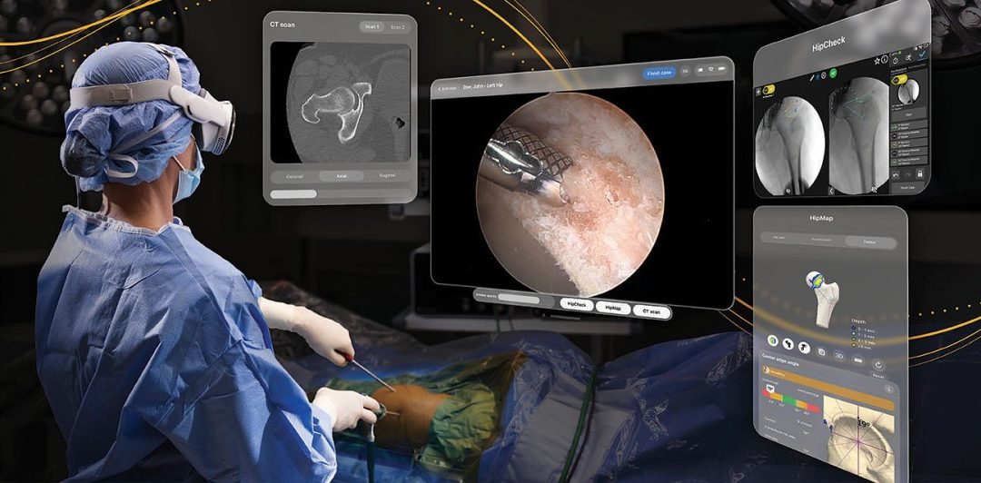 Stryker introduces an FDA-authorized surgical app for the Apple Vision Pro