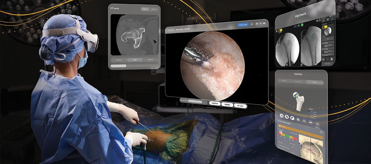 Stryker introduces an FDA-authorized surgical app for the Apple Vision Pro